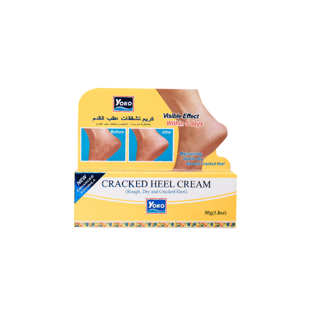 YOKO CRACKED HEEL CREAM 50 GM